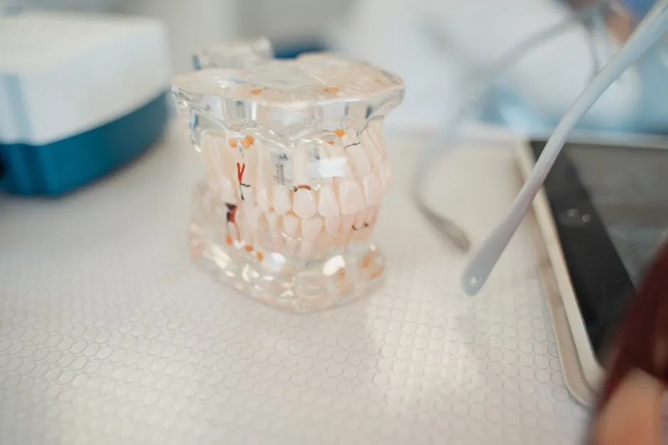 Modelo anatômico dental sobre mesa em ambiente clínico, com vista ampliada da arcada dentária